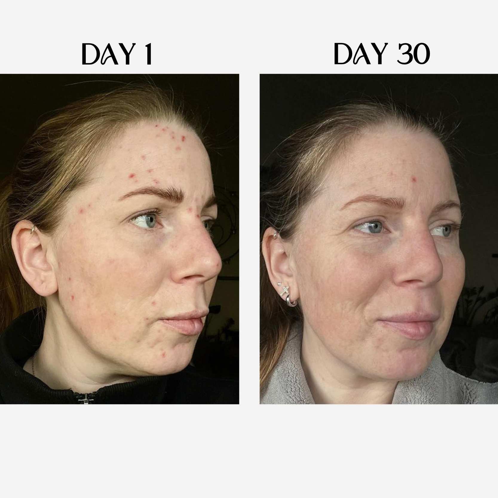 Dark Spots Eliminating Elixir